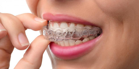 Rechinar los dientes por la noche: Causas y tratamiento