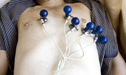 Sleeping with a Holter: How it works