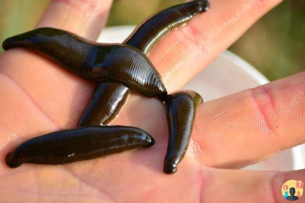 Dreaming of a leech: What meanings?