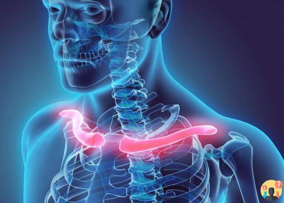 clavícula quebrada: como dormir?