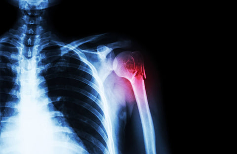 Relieving Shoulder Pain At Night: How To