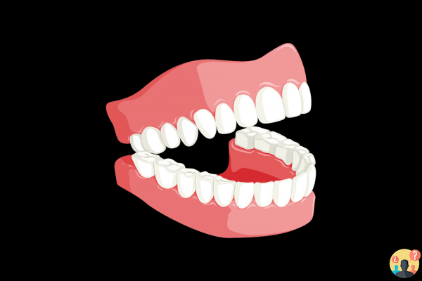 Sognare di perdere una dentiera: quali significati?