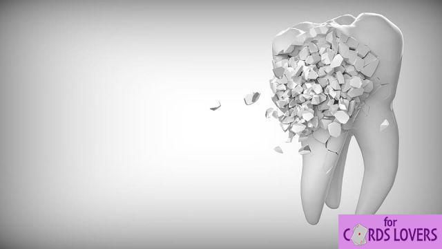 Sogna di perdere un dente anteriore: quali significati?
