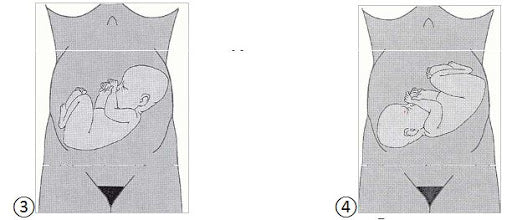 Baby in transverse: how to sleep?